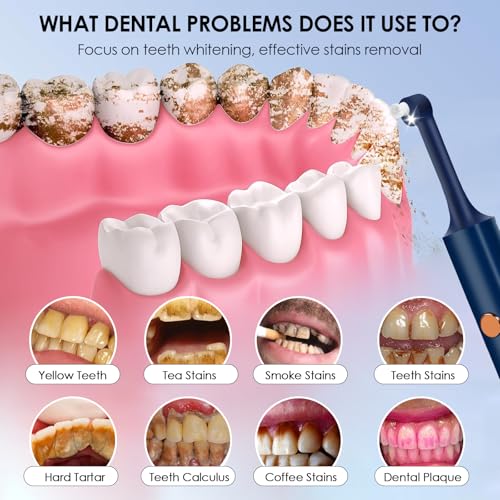 Zahnaufhellungsset, Wbbrbbr Zahnpolierer mit 4 Modi für Zahnreinigung & Zähne Aufhellen, zum Polieren nach der Zahnreinigung, Zahnaufhellung Bleaching Set mit 5 Köpfen und 3 Polierpasten (Blau) – Bild 3
