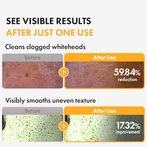 Hanskin PHA Pore Cleansing Oil - Korean Cleansing Oil for Face, Lightweight Makeup Remover & Oil Cleanser, Removes Makeup, Sunscreen & Excess Oil, Double Cleansing for Sensitive Skin, XL 10.14 oz - Image 4
