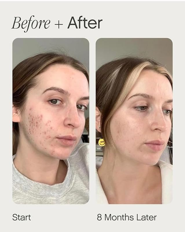 Image of Brightening And Clearing Serum Reduces Marks Facial Serum Reduce Wrinkles Skin Care Suitable For All Skin Types Hydrated Softer Skin 15 ML
