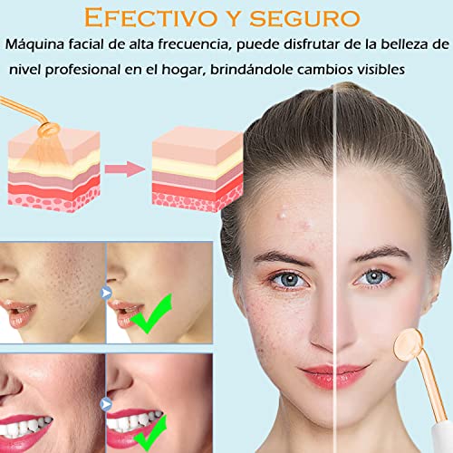 La Mejor comparativa de Maquina radiofrecuencia facial para comprar online. 16 La Mejor comparativa de Maquina radiofrecuencia facial para comprar online. 16