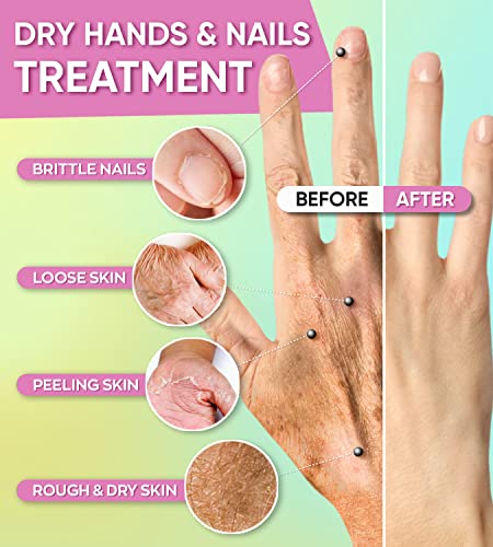 Moisturizing Hand Mask For Dry Cracked Hands & Nails - Hydrating Spa Treatment - Korean Collagen Gloves With Natural Plant Extracts - Nourishing Skin Care Gift With Shea Butter For Women & Men By Elixir (4 Pack) #TOP2