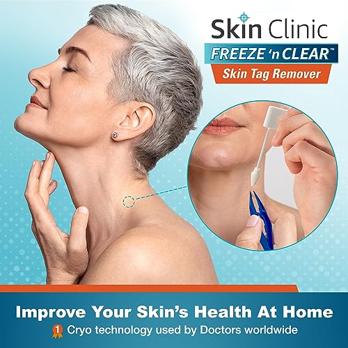 Skin Clinic Freeze 'N Clear SKIN TAG REMOVER Skintag Remover (Fda-Cleared) At Home Cryo Kit (As Little As 1 Treatment) 8 Applicators + Tweezers thumb #1