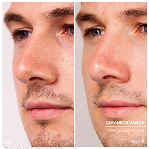 DOCTOR BABOR Cleanformance Gesichtstoner gegen fettige und glänzende Haut, Mit Mastix und Niacinamid, Aromatischer… - Image 5