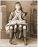 Vintage Freak Show Photo Of A Girl With Four Legs - Oddity 11x14 Unframed Poster-Victorian Circus Art Photograph, Antique Curiosity, 19th Century Memorabilia, & Retro Wall Art For Halloween Collection