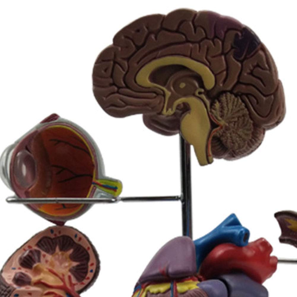 Cukrzyca Dla Lekarzy Biuro Narzędzie Edukacyjne Anatomia Człowieka Zestaw Modeli Cukrzycy 8-Częściowy Zawiera Stojak Do Wyświetlania - Podręcznik Medyczny