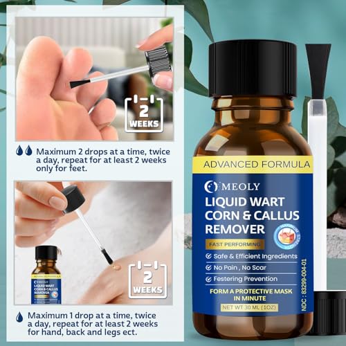 fast-acting wart remover freeze off  salicylic acid wart remover for plantar wart corn freeze off fast-acting for men and women 30 ml