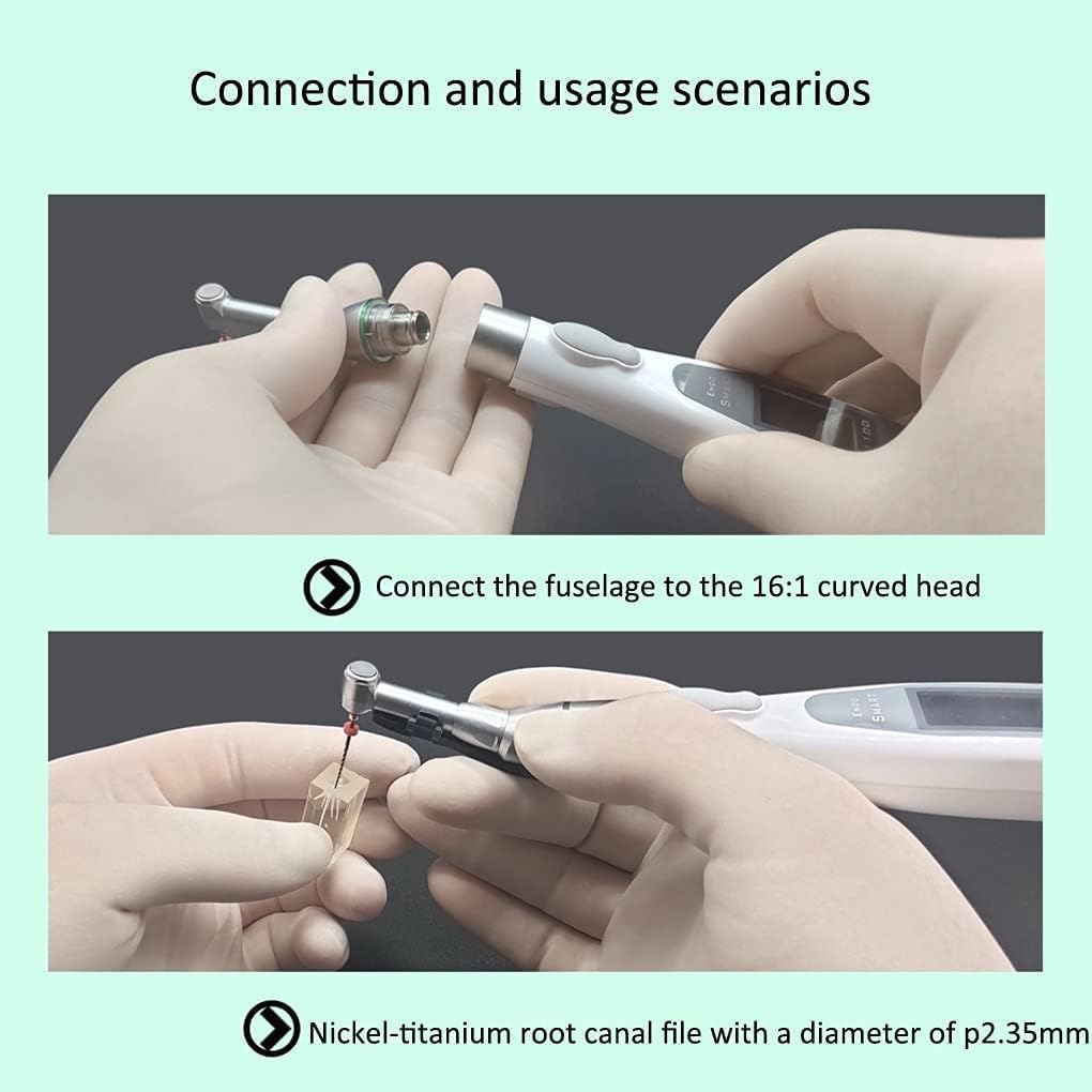 Dental Wireless LED Endo Motor 16:1 Hin und Herbewegung 9 Programmeinstellungen 360° Drehung Wurzelkanal Apex Locator