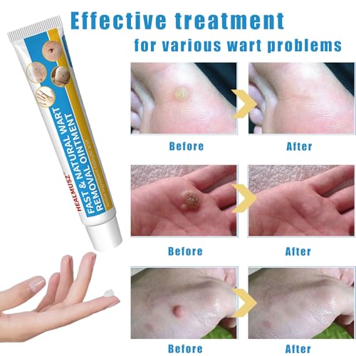 Image of HEALMUSZ Wart Remover Cream, Fast Acting Gel Wart Remover Freeze Off Ointment for Warts, Plantar Warts, Common Warts, Flat Warts, Corns, Calluses- All Skin Type