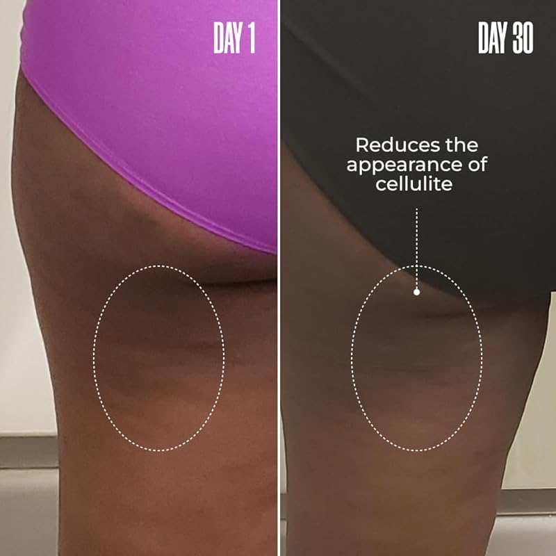 MAËLYS RE-LURE Tight & Tone Body Serum FAQ