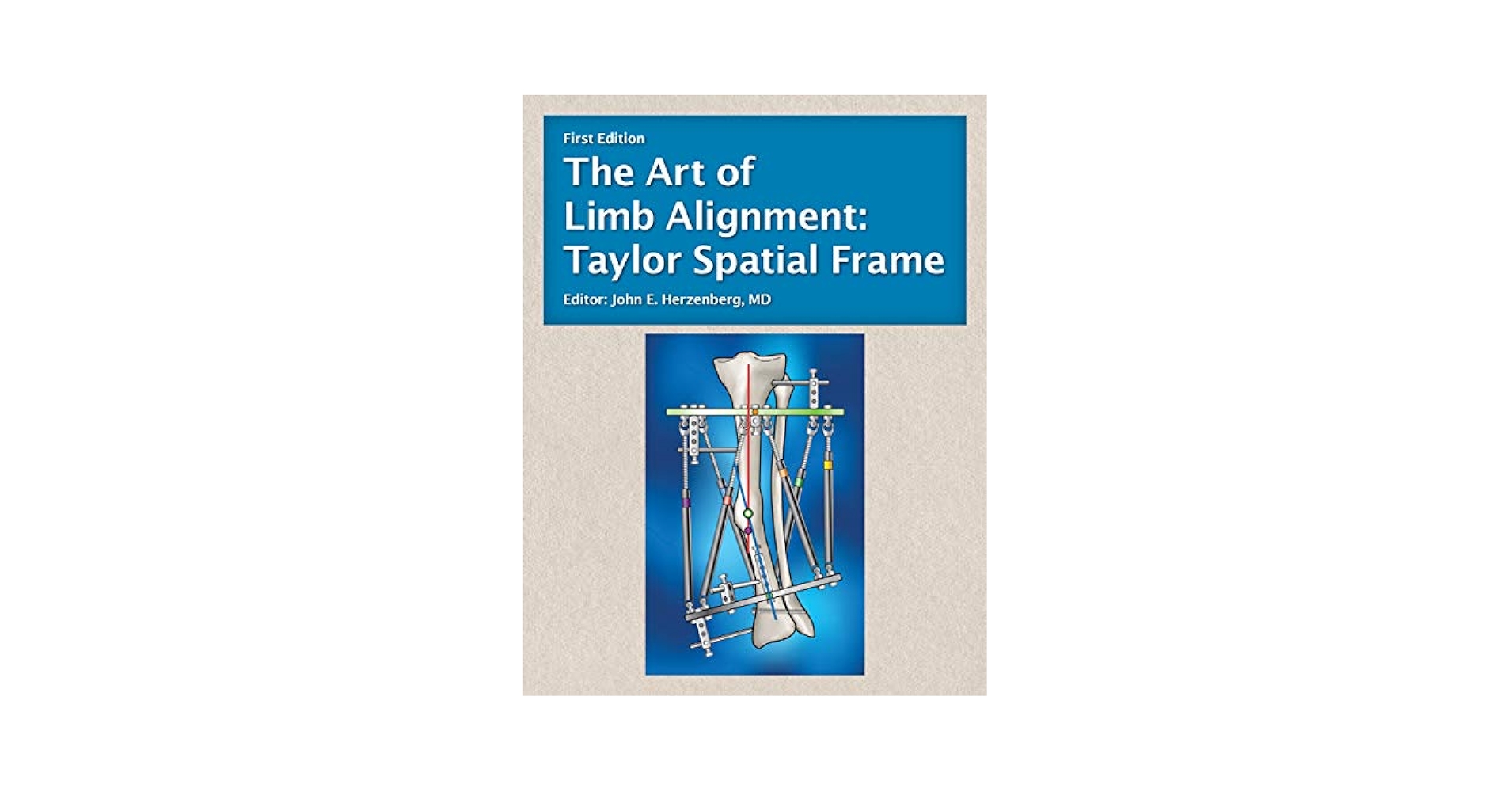 健康・医学 The Art of Limb Alignment, 12th Edition The Art of Limb Alignment by John E. Herzenberg | Goodreads