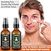 After Shave Balm for Men, Luxury After Shave Lotion for Mens Skin Care with Eucalyptus & Mint/Sandalwood - Cooling, Hydrating and Razor Bump Relief, Post Shave Balm Perfection for Soothe Skin