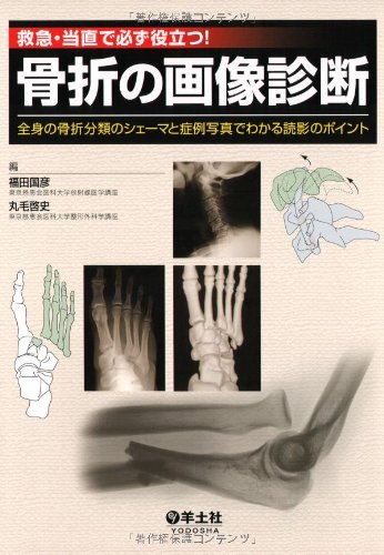 オライリー 無料電子書籍 救急・当直で必ず役立つ!骨折の画像診断―全身の骨折分類のシェーマと症 バイ