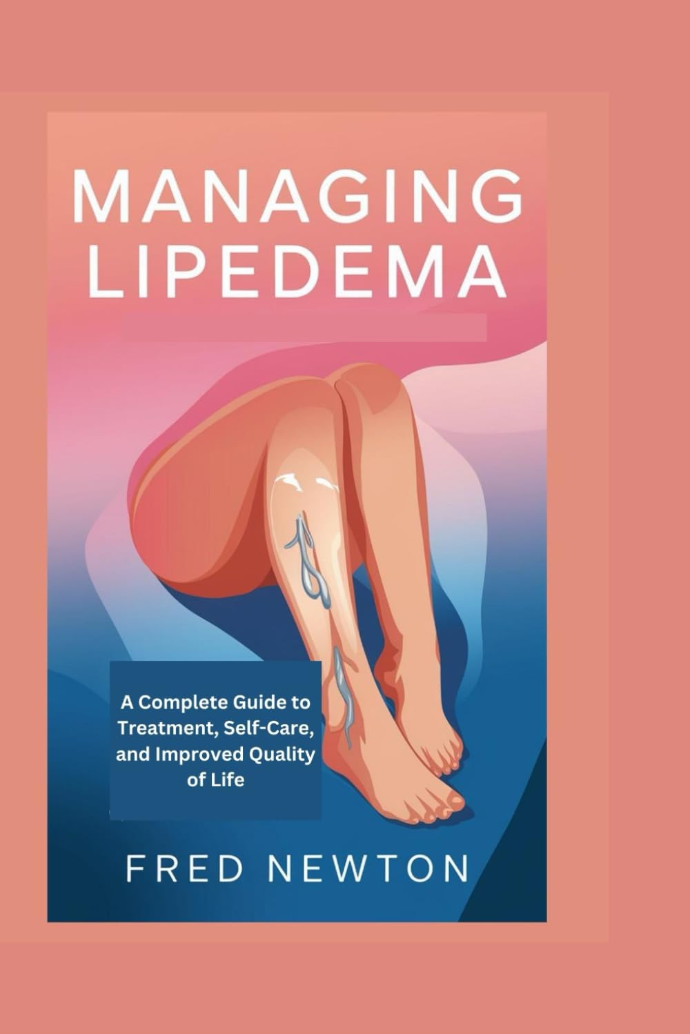 MANAGING LIPEDEMA: A Complete Guide to Treatment, Self-Care, and Improved Quality of Life