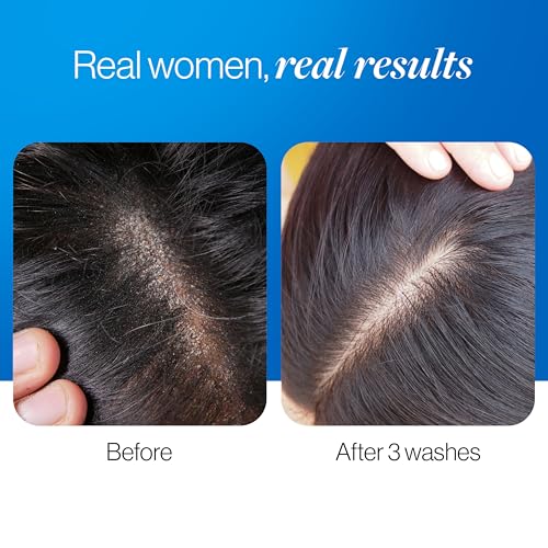 Be Bodywise Store Be Bodywise 1% ZPTO Anti Dandruff Shampoo 200ml - Image 5