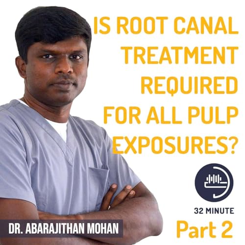 Is root canal required for all pulp exposures by Dr.M Abarajithan Part 2