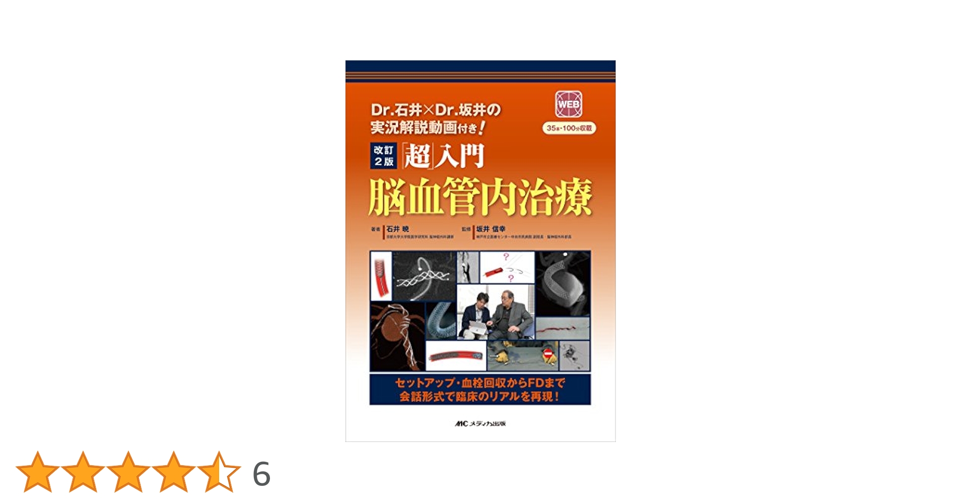 「超」入門脳血管内治療 セットアップ・血栓回収からFDまで【裁断済】 81wG37TP7cL._UF350,350_QL50_.jpg