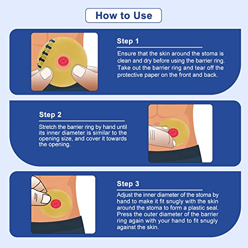 image for Carbou Ostomy Barrier Rings-Outer Diameter: 2