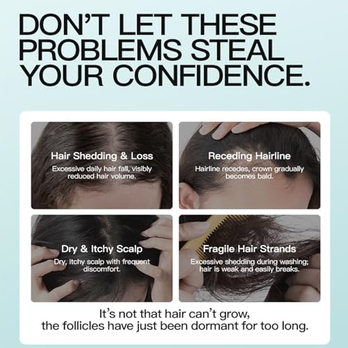 5% Minoxidil Hair Growth Cream - Anti-Hair Loss Treatment