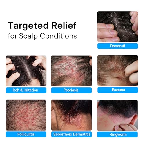 Image of ProBliva Psoriasis Scalp Spray: Scalp Treatment for Psoriasis, Dandruff & Seborrheic Dermatitis - On-Demand Itch Relief - Helps Relieve Flaking, Scaling & Dryness - Lightweight & Non-Greasy - 2 Pack