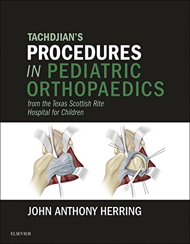 Amazon Com Tachdjian S Procedures In Pediatric Orthopaedics From The Texas Scottish Rite Hospital For Children E Book Ebook Herring John A Kindle Store