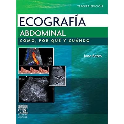 Ecograf&iacute;a abdominal