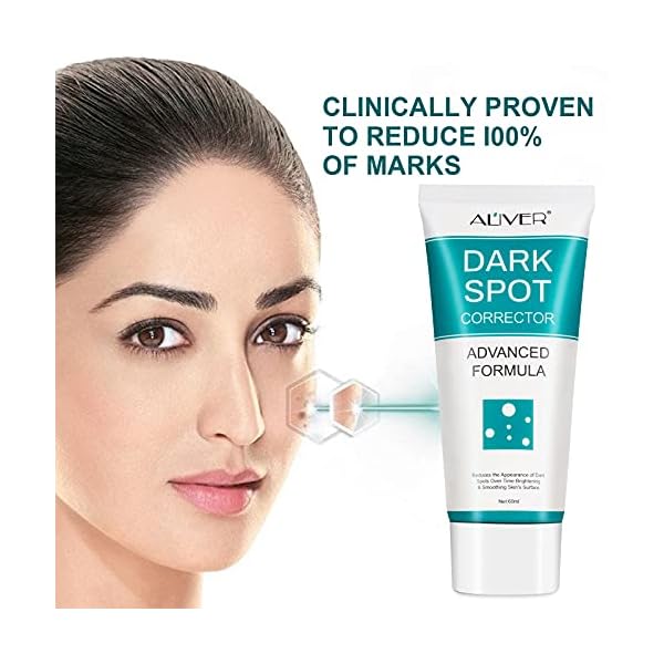 Dark-spot-remover-suitable-for-body-and-face-dark-spot-correcting-cream-containing-niacinamide-effectively-diminish-the-black-deposits-of-the-skin-improve-the-complexion-suitable-for-all-skins Dark spot remover, suitable for body and face, dark spot correcting cream containing niacinamide, effectively diminish the black deposits of the skin, improve the complexion, suitable for all skins