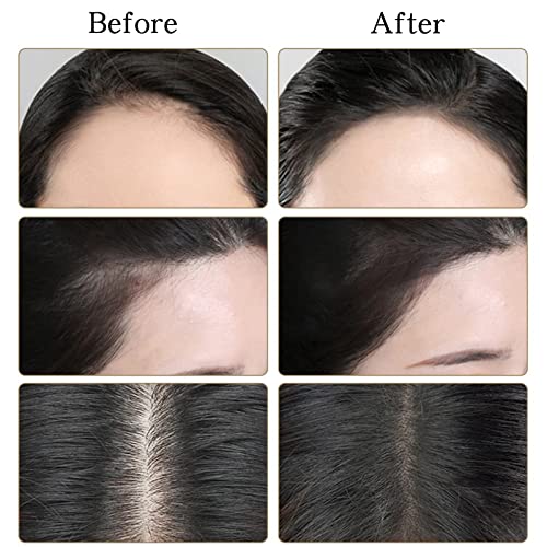 Hairline Powder Hair Shadow Powder For Filling In Thinning Hair Hair Root Dye Touch Up Hair Powder Hair Root Concealer For Makeup For Men And Women Black #TOP2