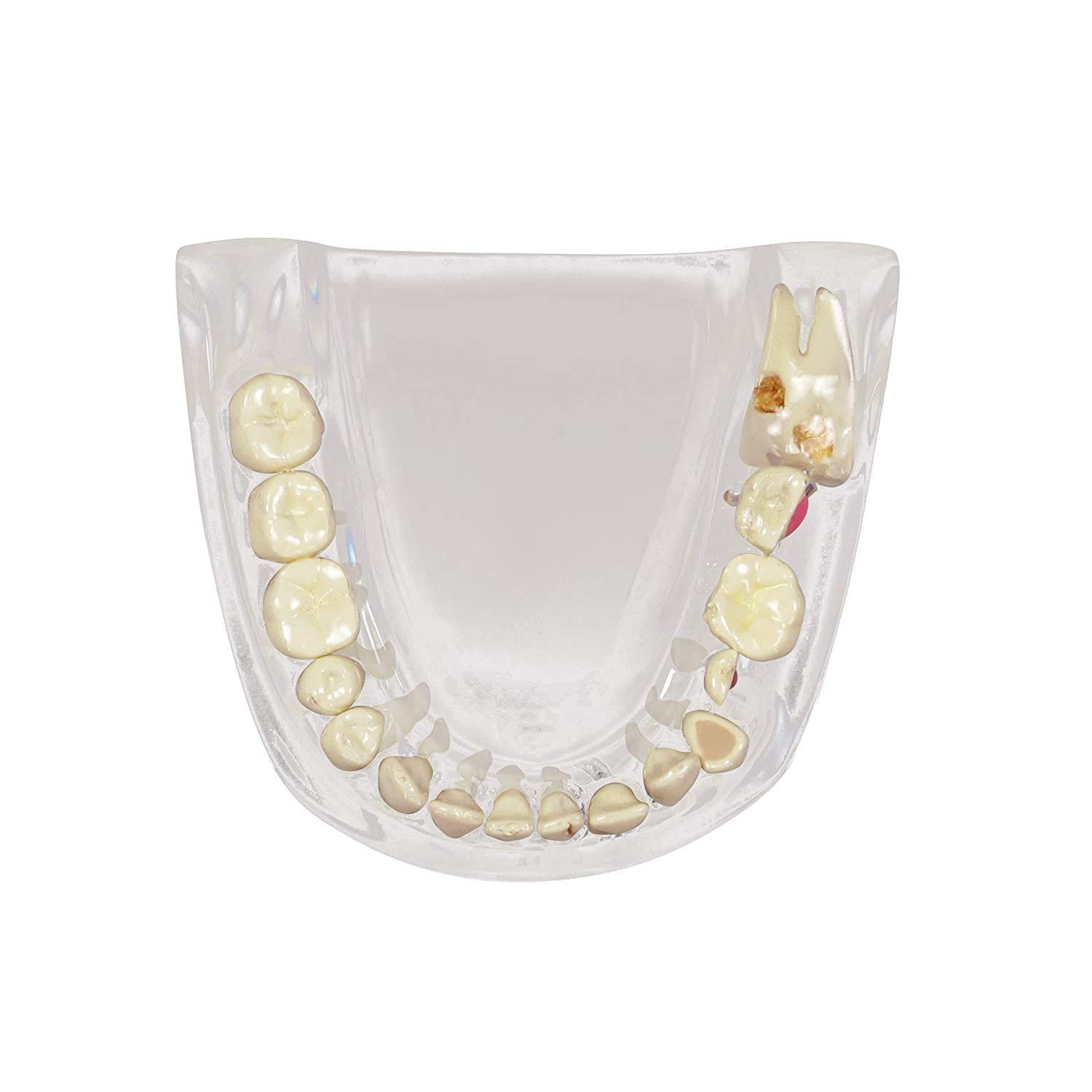 Modello anatomico dentale di mascella con denti per uso educativo, perfetto per studi dentisti e studenti di odontoiatria, replica anatomica del corpo umano