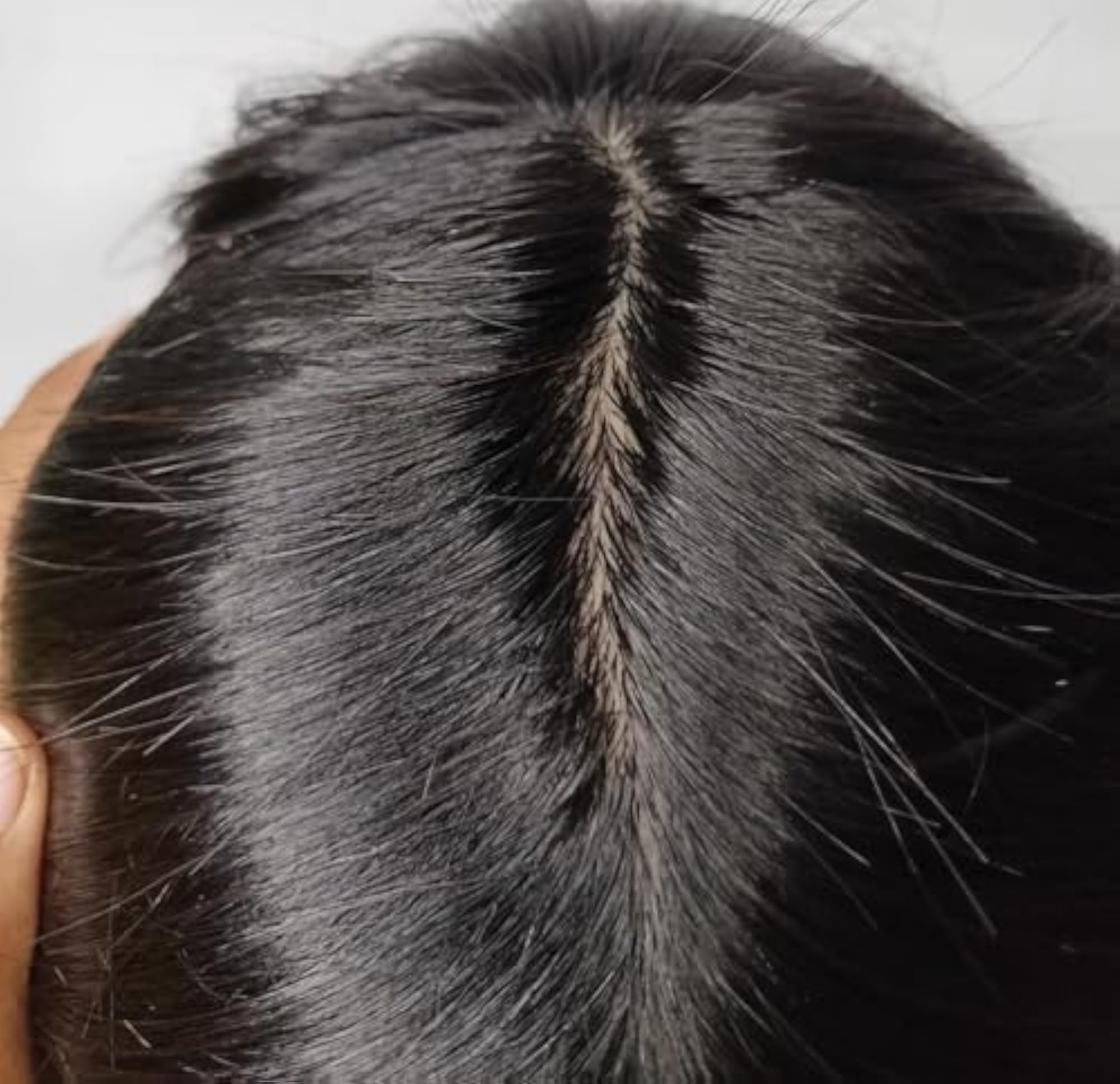 Men's 9x6 Inch Golden Mirrage Skin Base Hair Patch