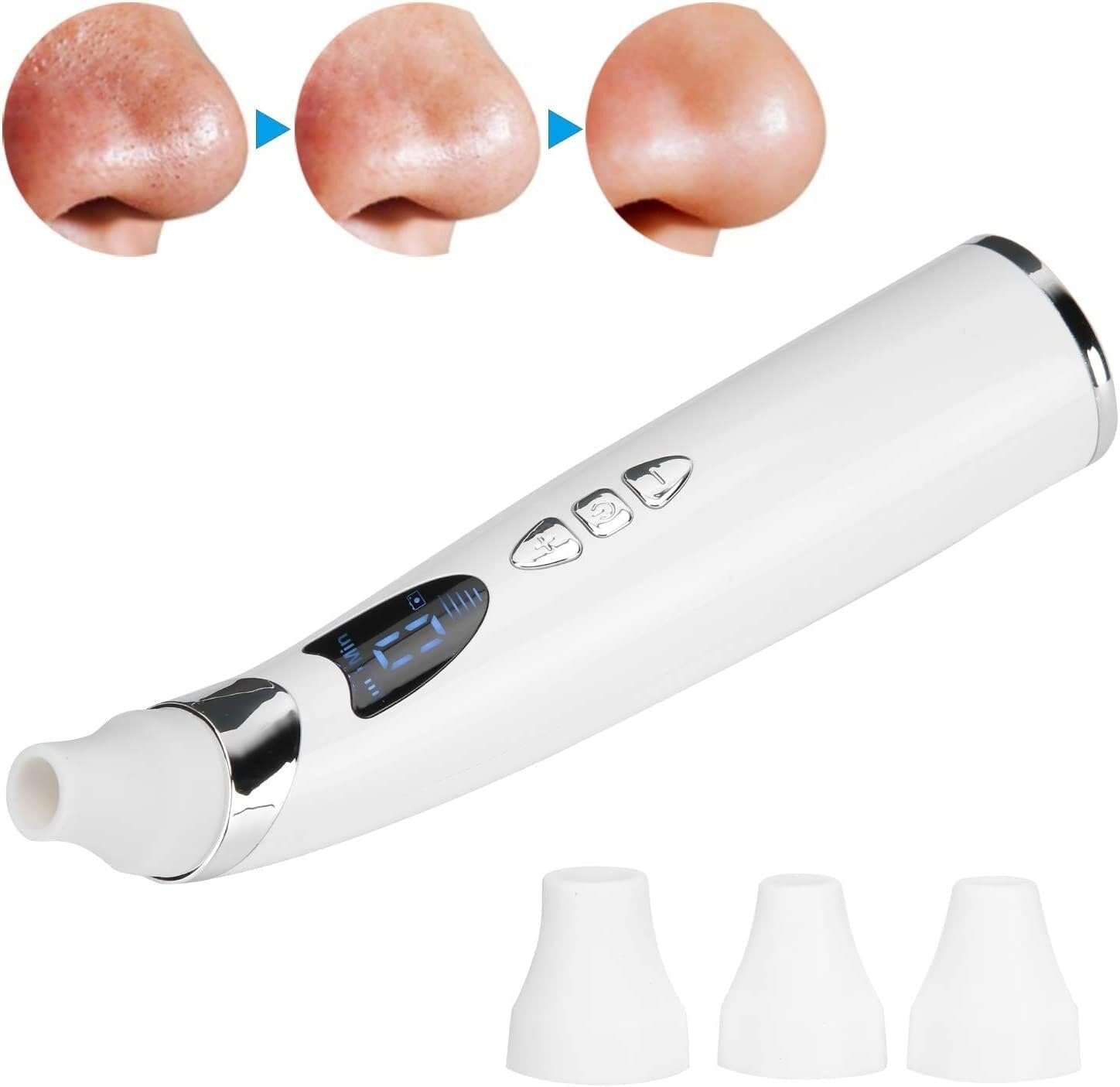 Aspirapolvere, Macchina for la rimozione visiva dei Punti Neri Aspirapolvere Pulitore for pori Aspiratore Punti Neri Aspirapolvere for pori Aspirazione Rimozione dell'acne Detergente Elettrico