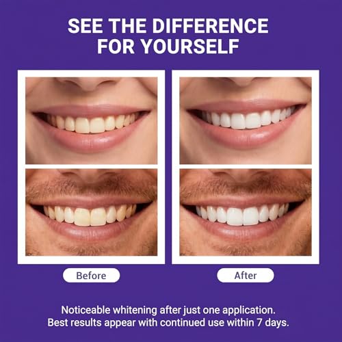 Image of Advanced Purple Teeth Whitening Strips, 28-Day Premium Color Correcting System, Peroxide-Free & Enamel-Safe Tooth Whitener for Sensitive Teeth, Luxury At-Home Smile Care (2 Boxes)