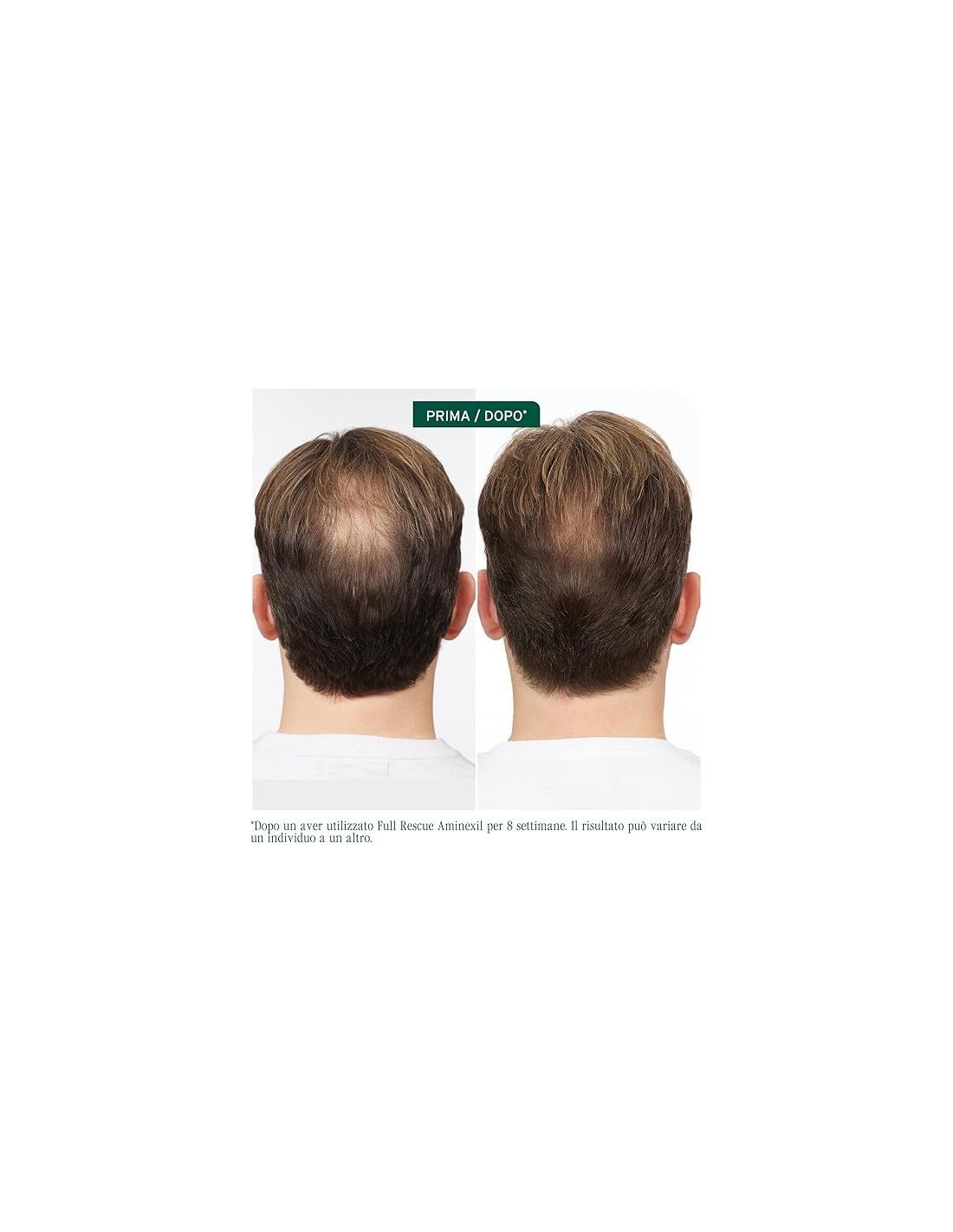 Biolage Cofanetto Full Rescue Trattamento Anti-Caduta | shampoo 400ml + Fiale per Capelli 6 x 20 fiale