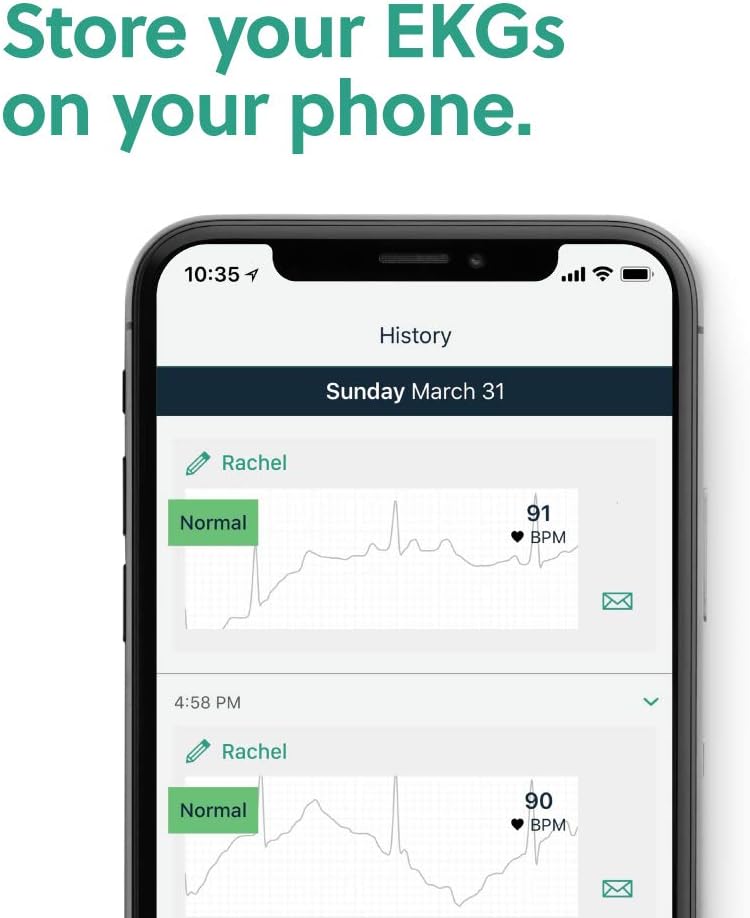 KardiaMobile Single-Lead Personal EKG Monitor | FDA-Cleared | Detects AFib : Sports & Outdoors