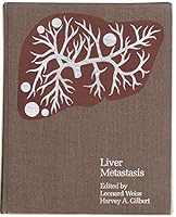 Liver Metastasis: A Monograph Series (Metastasis) 0816122261 Book Cover
