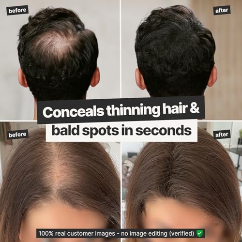 IMPERIO Hair Fibres for Thickening & Full Hair in Seconds. Shake-on hair filler for an Authentic Look. 100% Natural! Premium Salon Quality Hair Building Fibres - Image 2