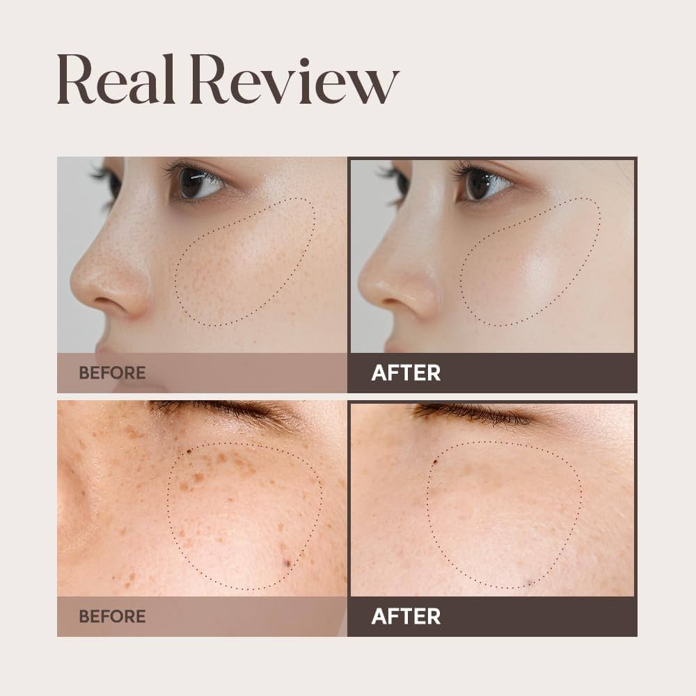 Amazon.com: Lulubeu Mela Clinic Ampoule with NK Cell Technology