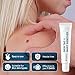 Skin Tag Remover Cream for Safe & Effective Skin Tag Removal, Natural Ingredients
