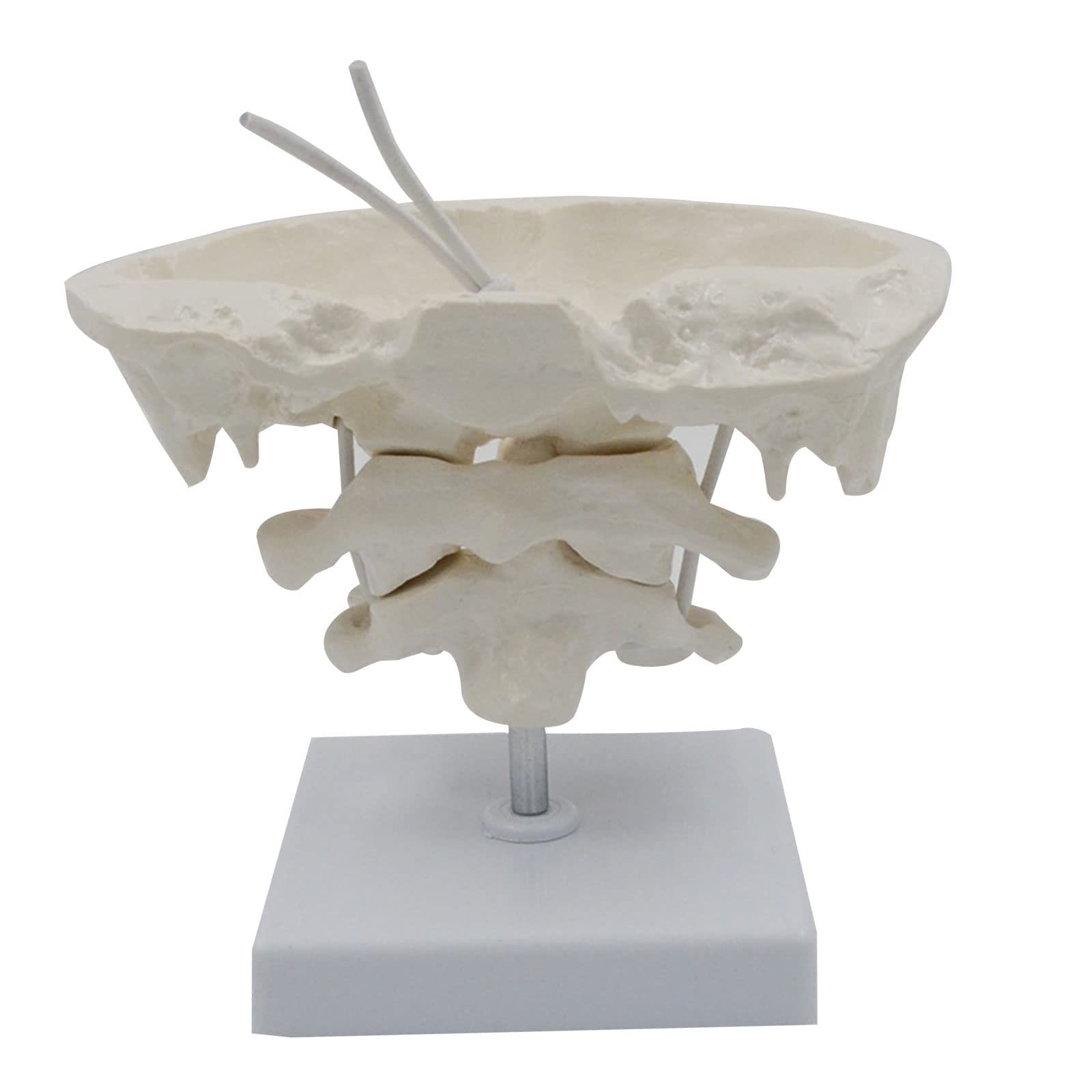 RBRMHM 1.5X Magnification Human Cervical Model Occipital Bone Model Medical Teaching Educational Model Teaching Aid