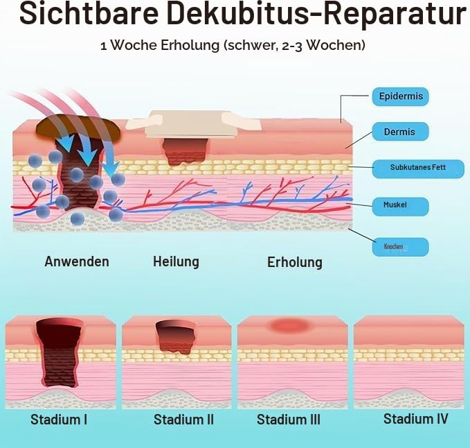 ishancare® Dekubitus-Creme - Schnell & sicher natürlich heilende Dekubitus-Creme, Dekubitus-Wundpflege-Heilsalbe, Behandlung von Dekubitus Druckgeschwüren Diabetiker-Geschwüren Wunden Verbrennungen un