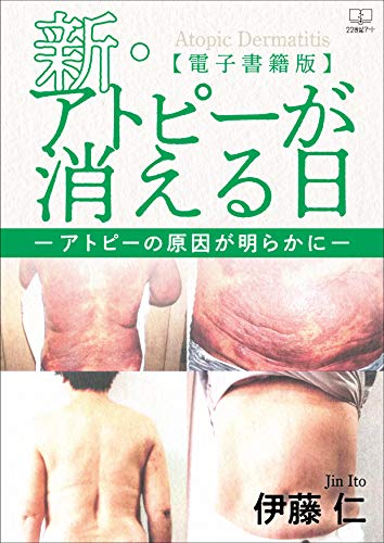 Amazon Co Jp 新 アトピーが消える日 アトピーの原因が明らかに 電子書籍版 ２２世紀アート Ebook 伊藤 仁 本