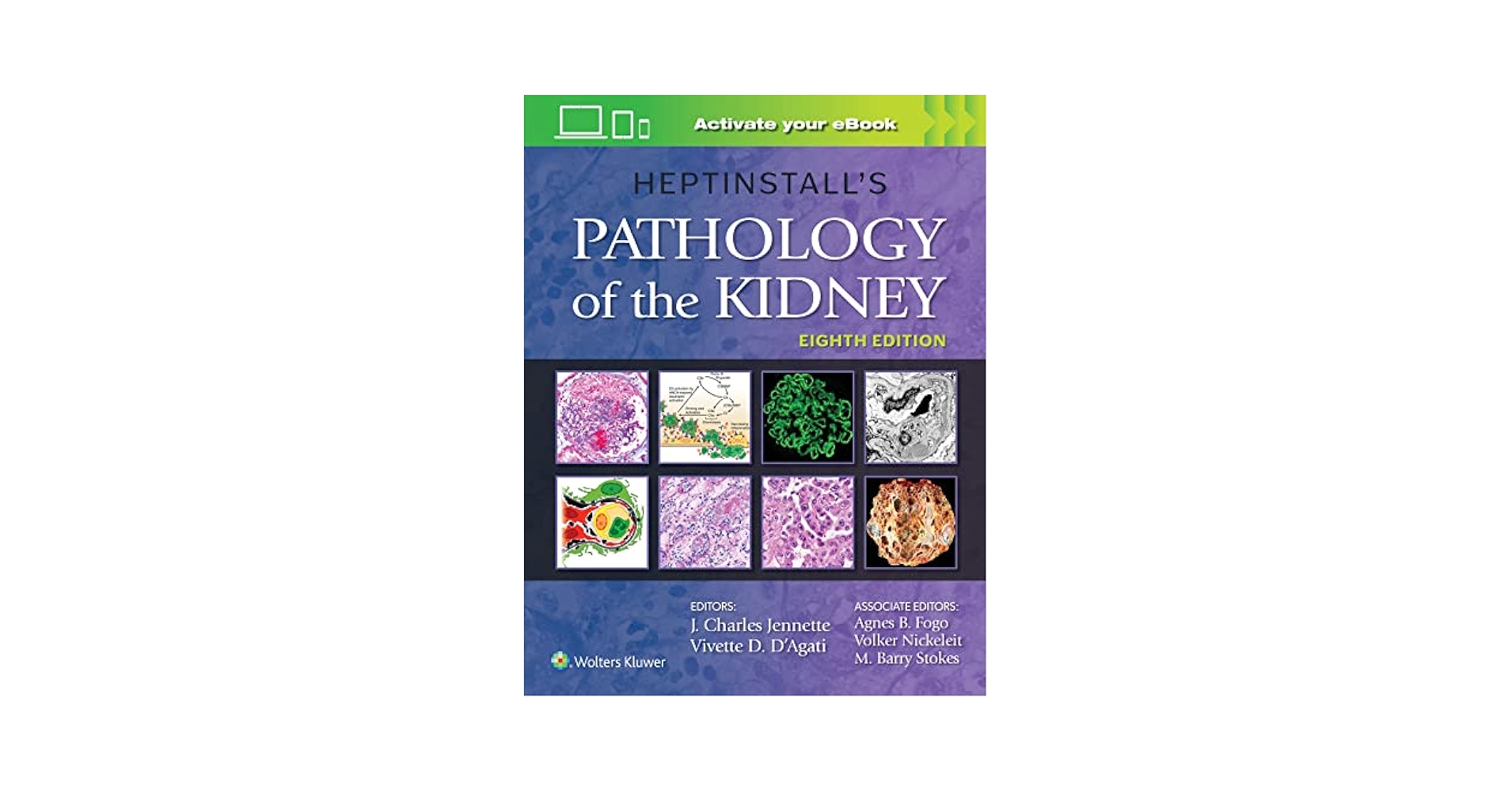 健康・医学 HEPTINSTALL'S PATHOLOGY of the KIDNEY Amazon.com: Heptinstall's Pathology of the Kidney eBook