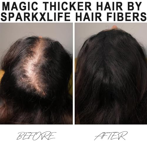 Image of Hair Fiber White - Keratin Thick Fiber & Hair Building Fibre for Men & Women - Instant Concealer & Filler powder for Thinning Hairline & Bald Spots (27.5g) (White)