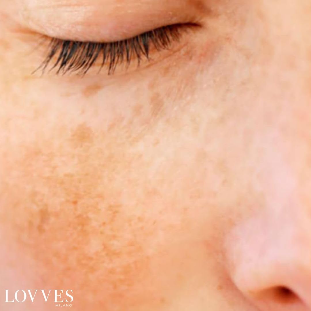 LOVVES Siero Viso Anti macchie, Schiarente, Alta Cosmesi Naturale, Depigmentante, Riduce le Ipercromie della Pelle, Previene la Formazione di macchie scure, Pelle più Uniforme e Luminosa, Flacone 30ml