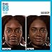 Maybelline Dream Pure Skin Clearing BB Cream, 8-in-1 Skin Perfecting Beauty Balm With 2% Salicylic Acid, Sheer Tint Coverage, Oil-Free, Deep, 1 Count