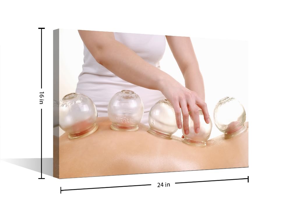Image of 1 Panels Artwork Traditional Chinese Cupping Therapy Paintings Canvas Wall Art Cupping Massage Wall Pictures Framed Wall Art Posters & Prints Stretched and Framed Ready to Hang (16 inch Wx24 H)