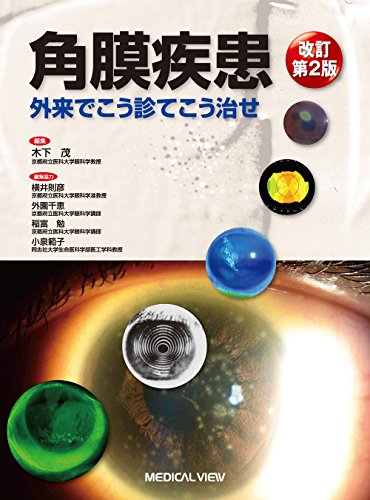 オライリー 無料電子書籍 角膜疾患−外来でこう診てこう治せ バイ