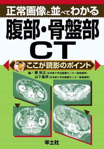 無料電子書籍 アプリ 正常画像と並べてわかる腹部・骨盤部CT (ここが読影のポイント) バイ