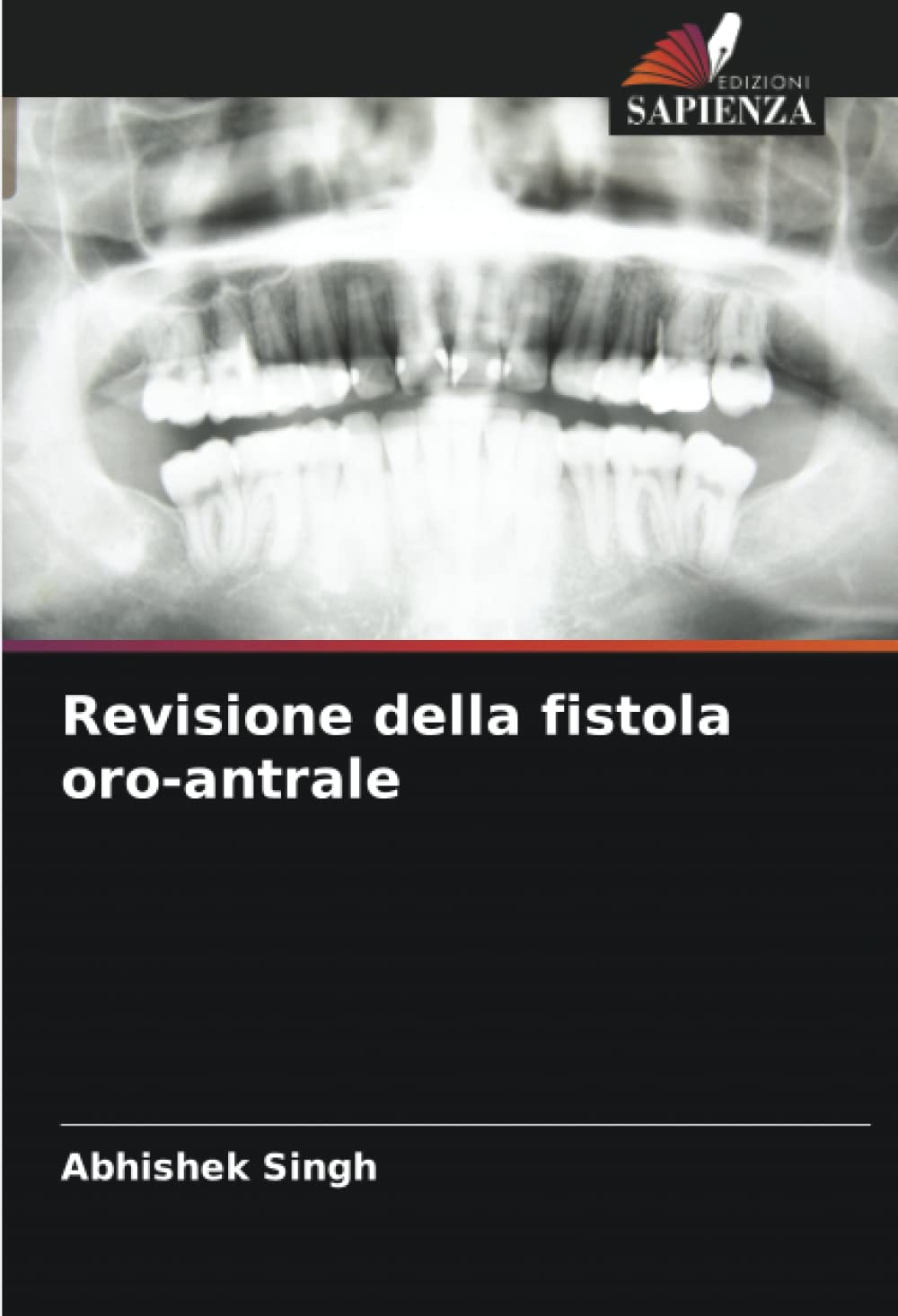 Revisione della fistola oro-antrale