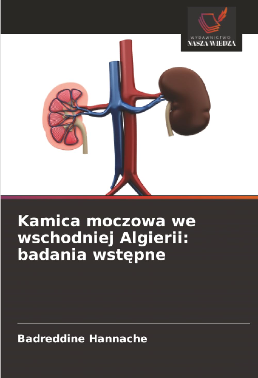Kamica moczowa we wschodniej Algierii: badania wst¿pne