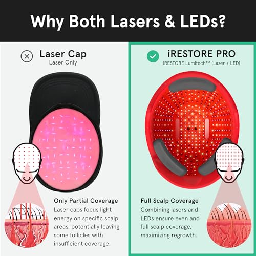 iRestore Laser Therapy System for Hair Growth - FDA Cleared Treatment for Men & Women